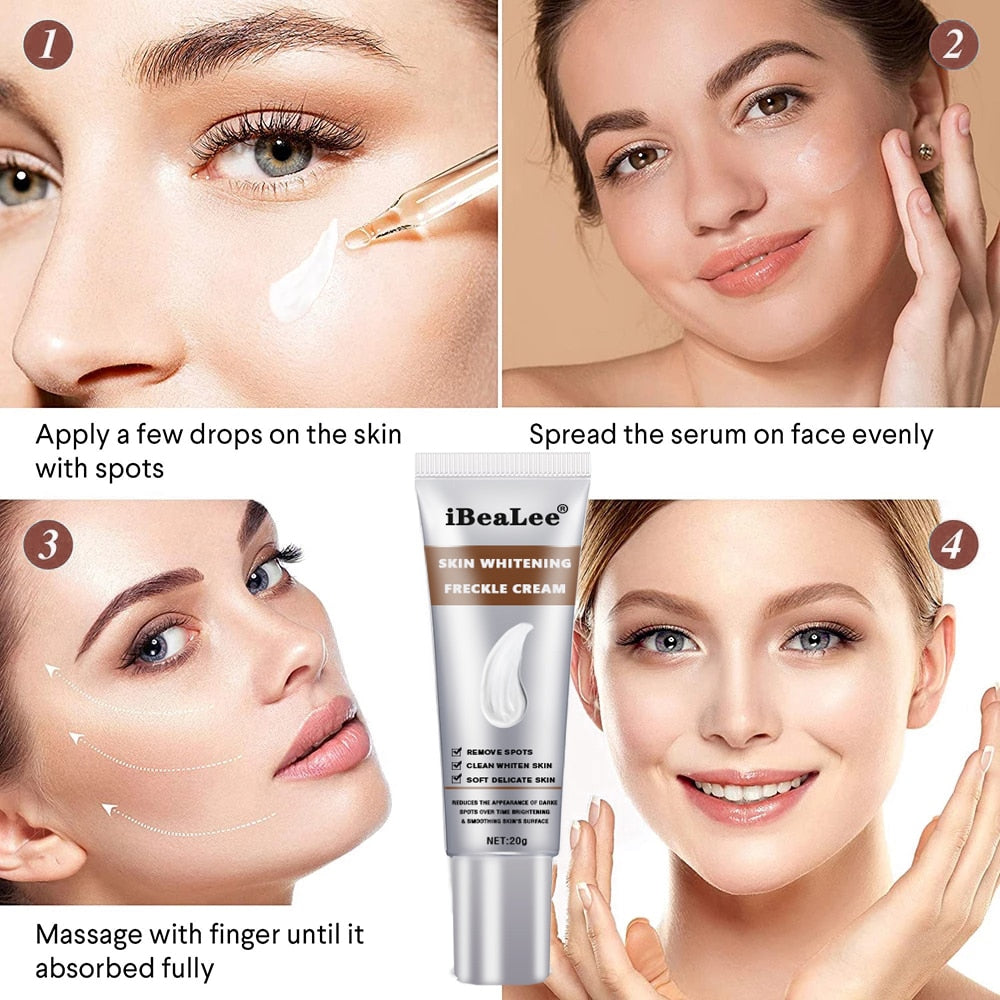 iBeaLee Whitening Freckle Cream Remove Melasma Cream Remove Dark Spots Melanin Melasma Remover Brighten Skin Anti-Aging