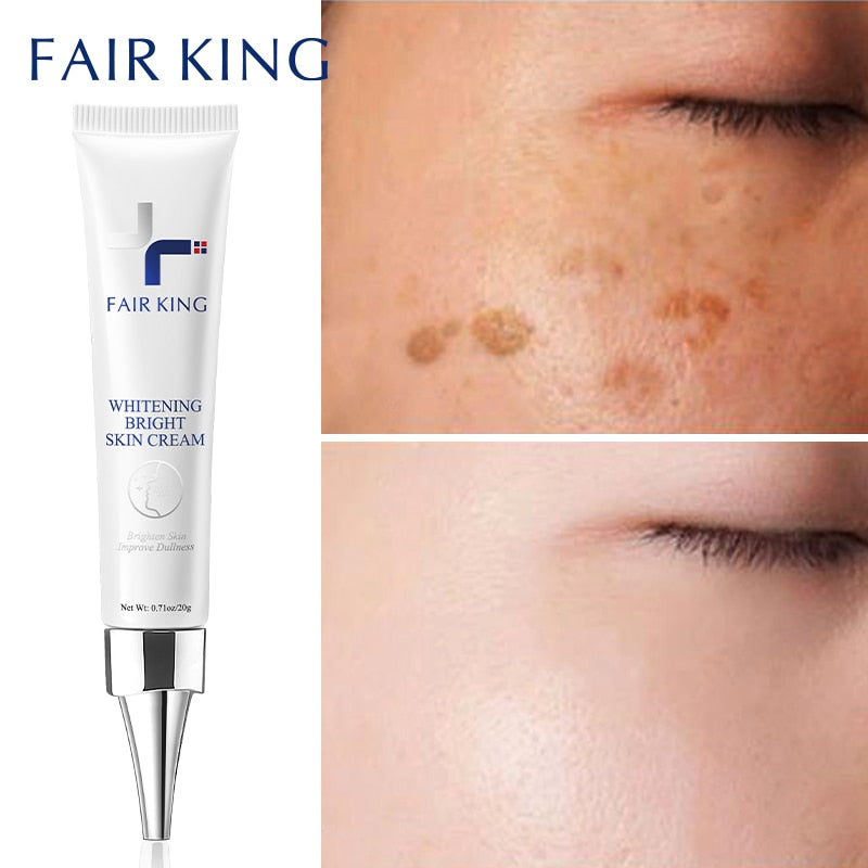Dark Spot Corrector Skin Whitening Fade Cream Lightening Blemish Removal Serum Reduces Age Spots Freckles Face Cream 20g