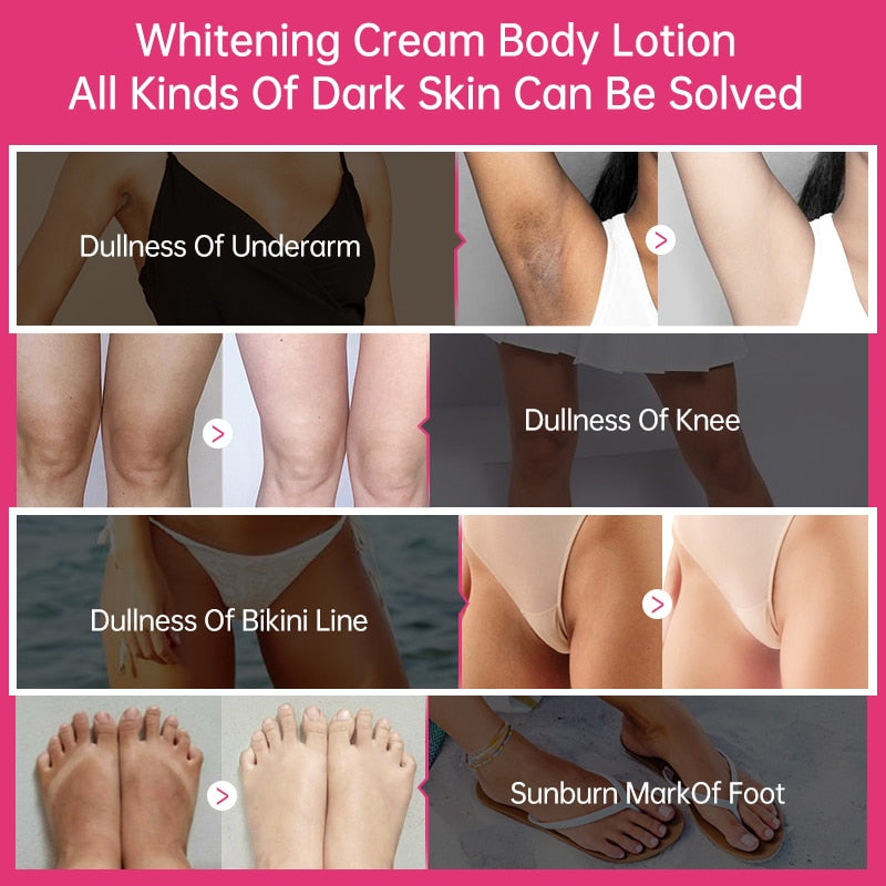 Whitening Cream for Dark Skin Armpit Lightening Intimate Areas Underarm Body Skin Care Private Parts Whiten Cream Beauty Health